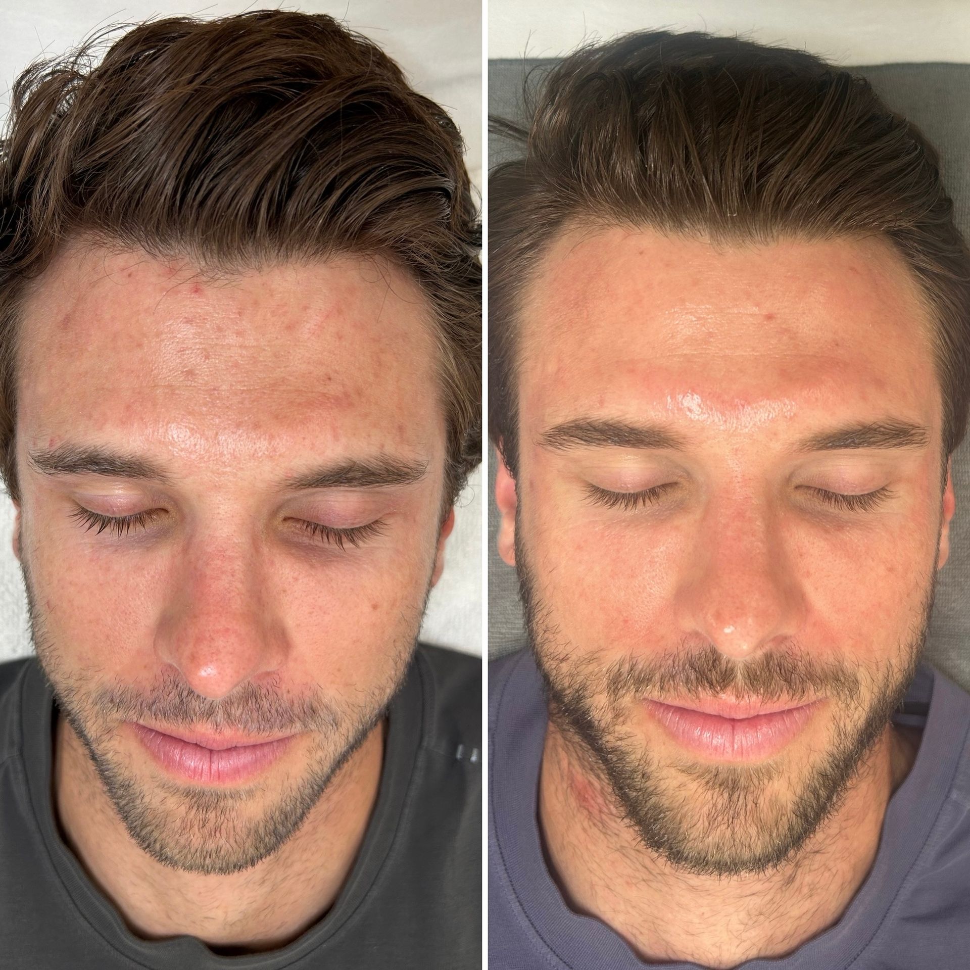 mens skin care denver