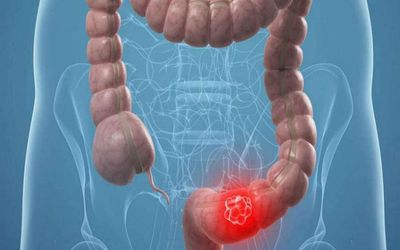 GASTROENTEROLOGO