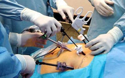 HERNIAS