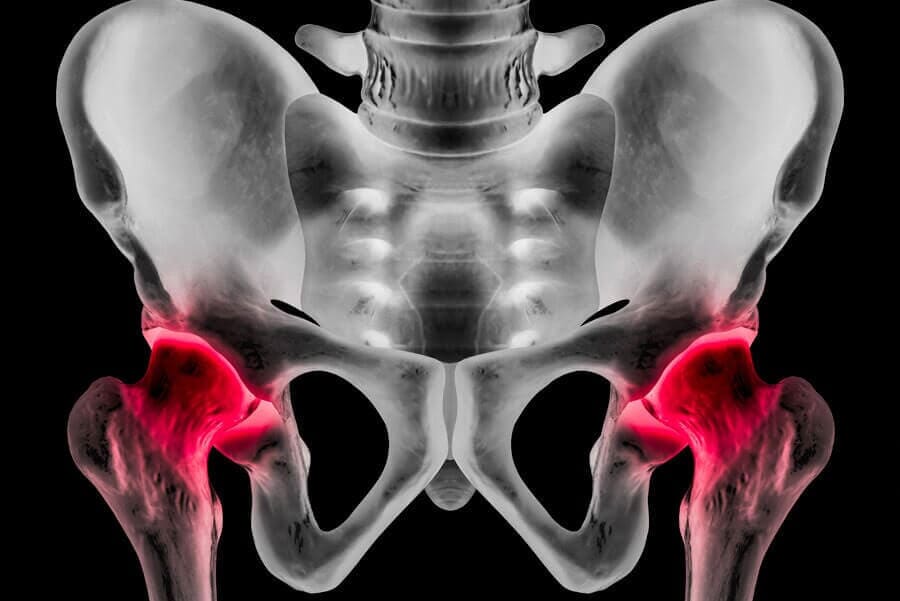 DR. J. MAURICIO LÓPEZ MANRIQUE- cadera y pelvis