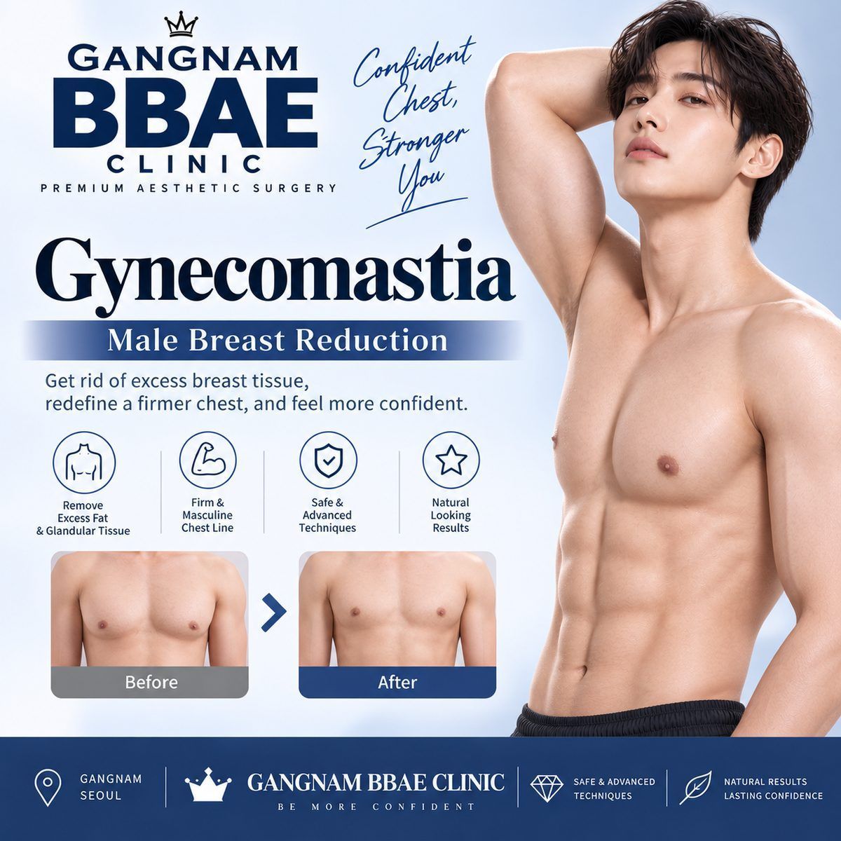 서울 강남 빼빼의원 여유증 수술 – 전후 결과