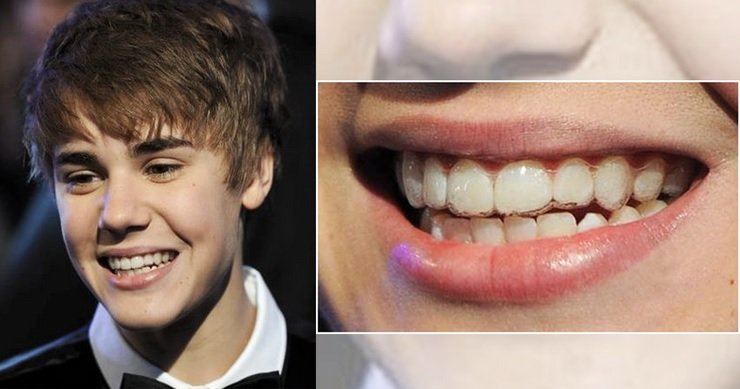 A picture of justin bieber and a picture of his teeth