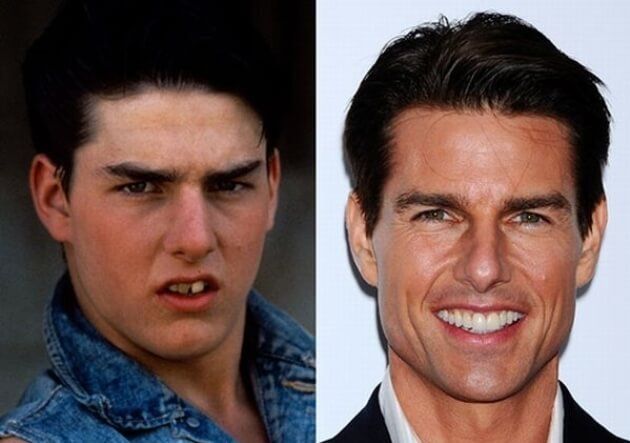 A picture of a young tom cruise and a picture of him smiling