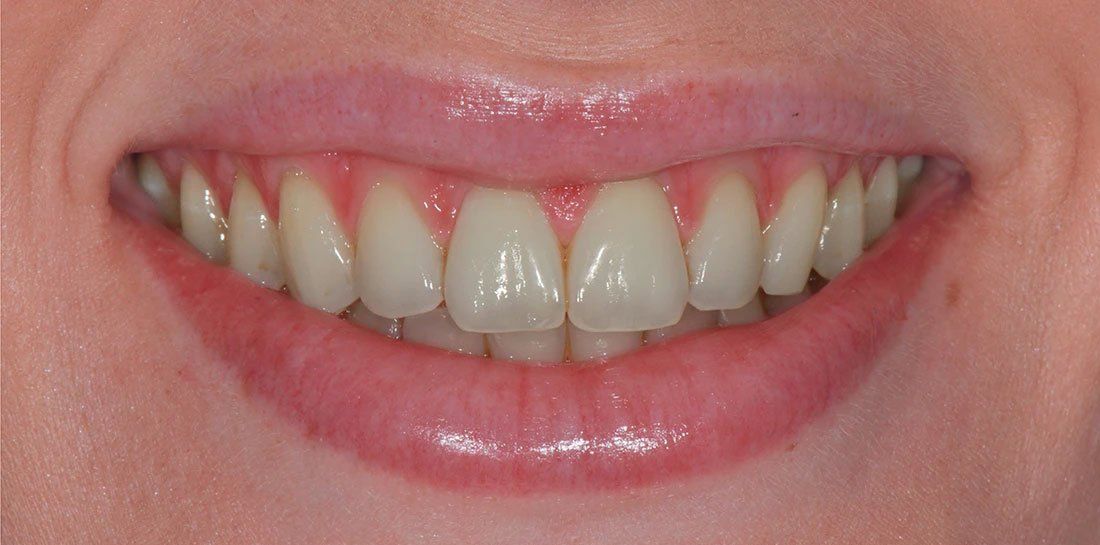 A close up of a woman 's smile with white teeth and red lips.