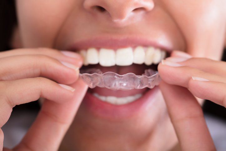 A woman is putting a clear brace on her teeth.