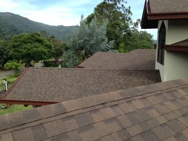 Shingles