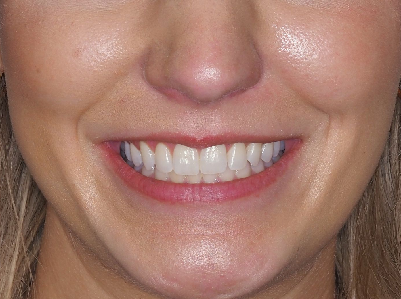Close-up of a person smiling, showing white teeth, full lips, and a fair complexion.