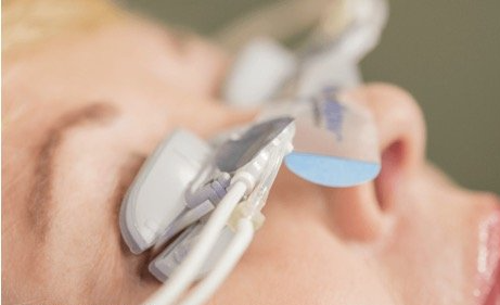 woman receiving lipiflow treatment