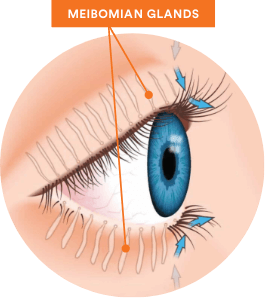 Drawing of meibomian glands