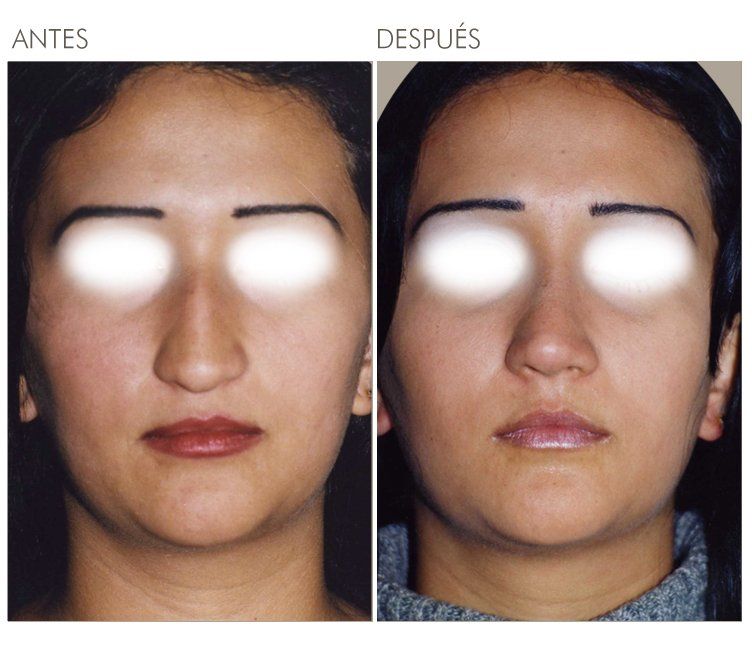A before and after photo of a woman 's face in spanish