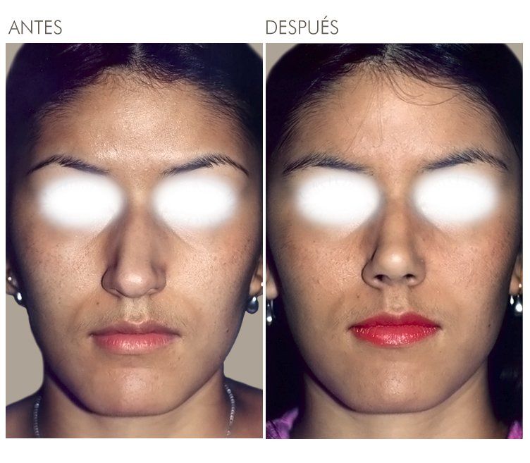 A before and after photo of a woman 's face in spanish