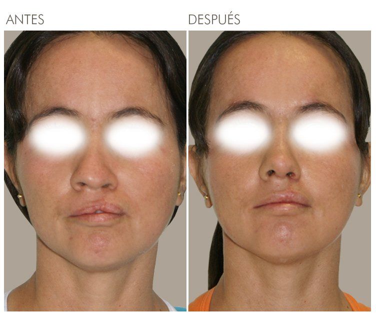 A before and after photo of a woman 's face