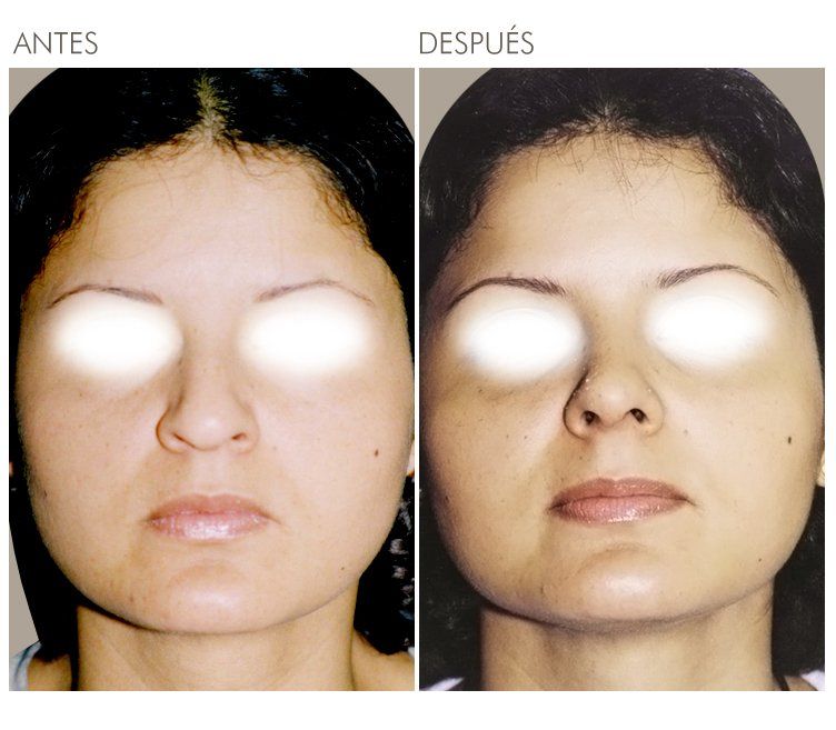 A before and after photo of a woman 's face in spanish