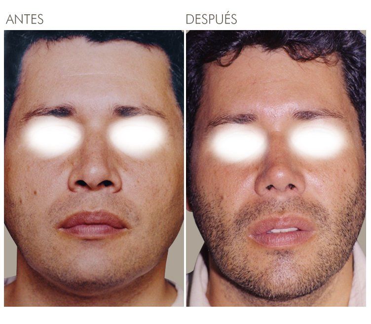 A before and after photo of a man 's face