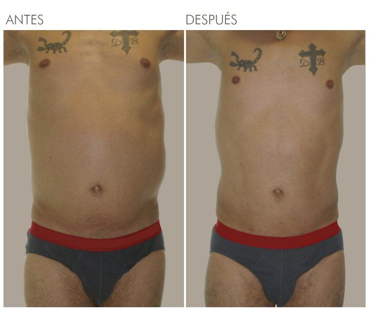 A before and after picture of a man with tattoos