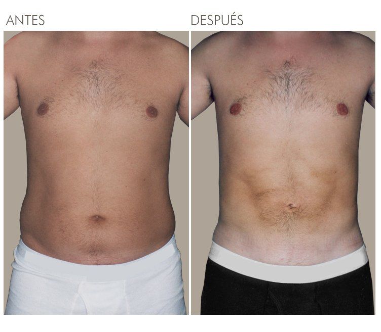 A before and after picture of a man 's torso