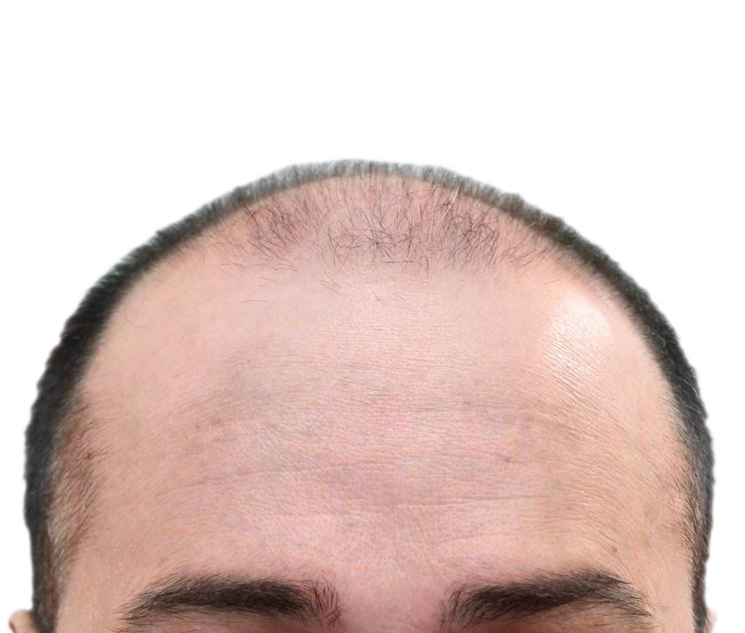 A man with a bald head is looking at the camera with his eyes closed.