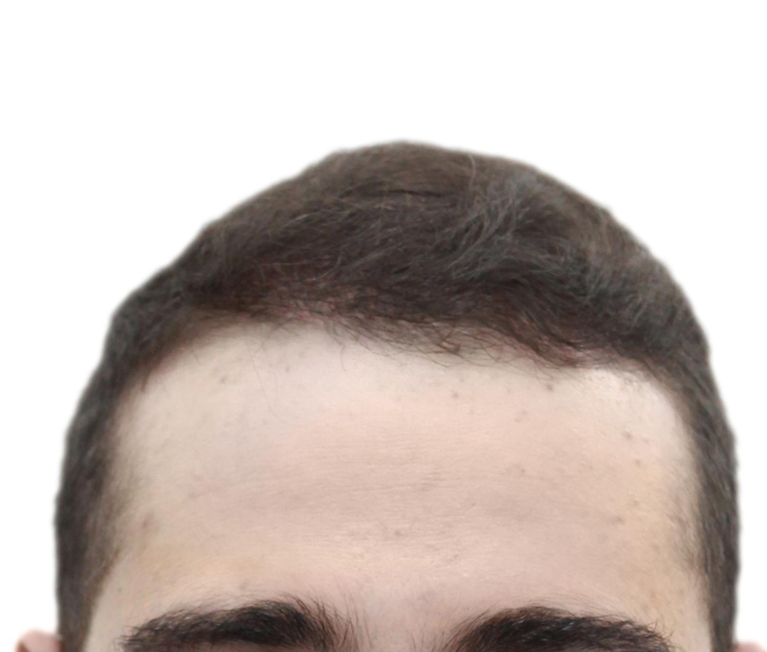 A close up of a man 's head with a white background.