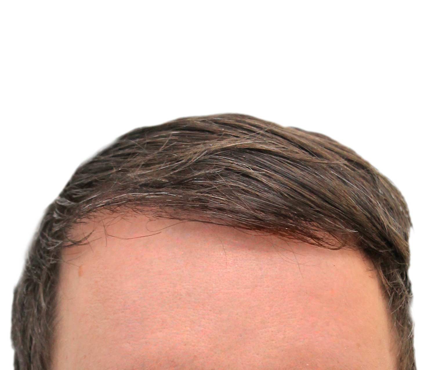 A close up of a man 's forehead with a white background.