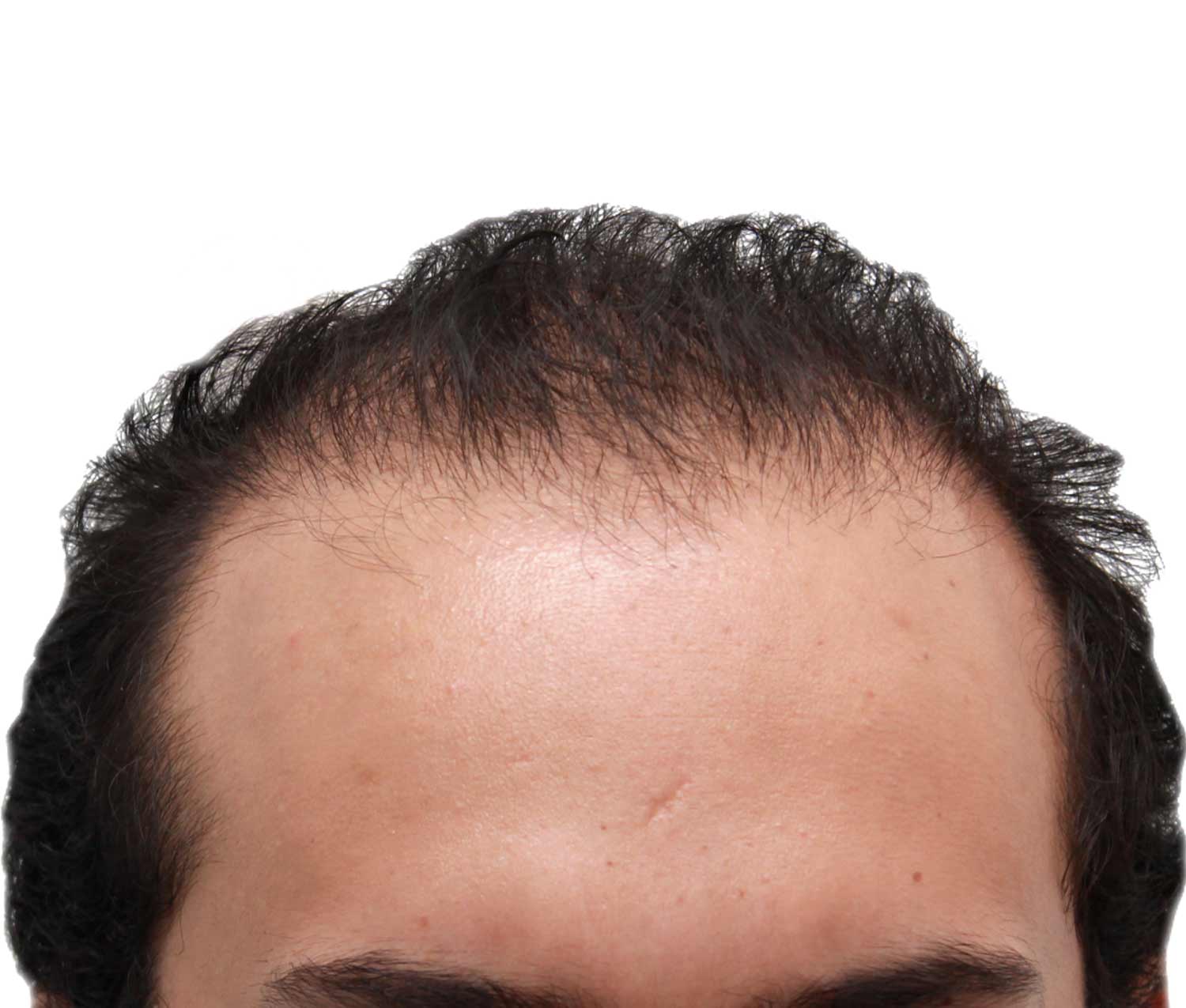 A close up of a man 's head with a white background