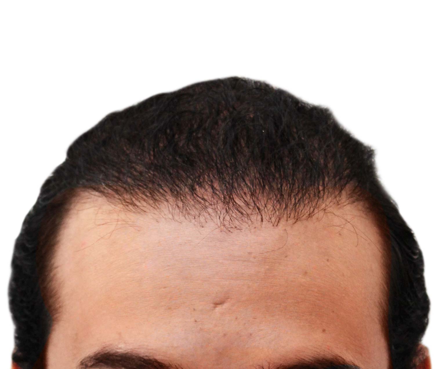 A close up of a man 's head with a white background