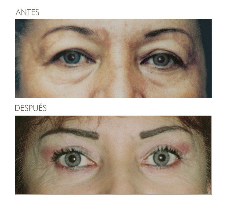 A before and after photo of a woman 's eyes in spanish