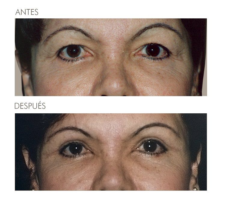 A before and after photo of a woman 's eyes