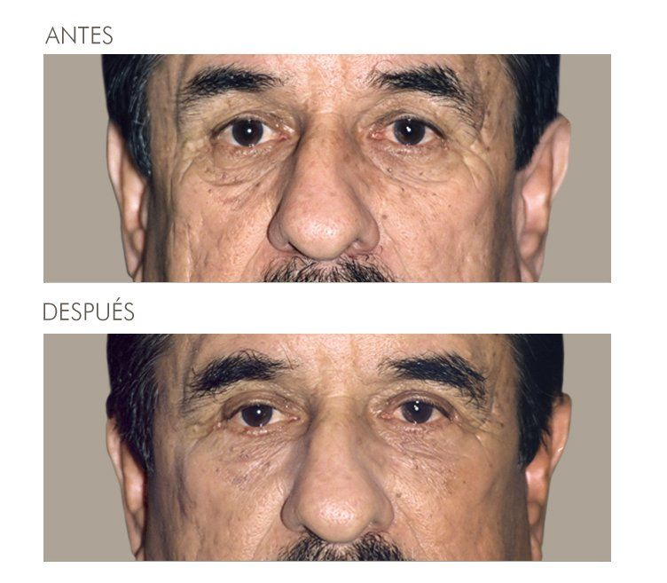 A before and after picture of a man 's face