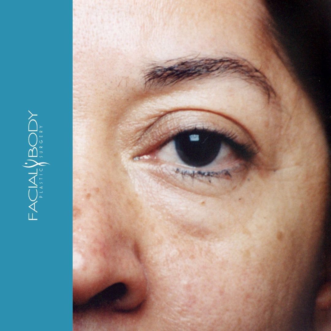 A close up of a woman 's eye with a blue background that says facial body