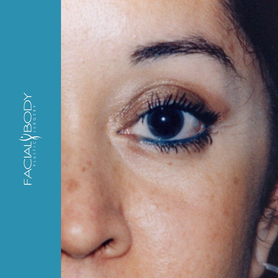 A close up of a woman 's face with facial body written on the bottom
