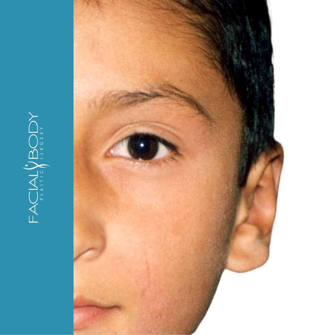 A close up of a child 's face with the words facial body below it