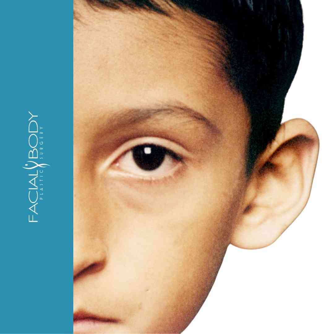 A close up of a child 's face with the words facial body below it