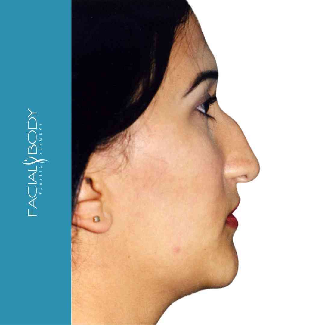 A close up of a woman 's face with facial body written on the bottom