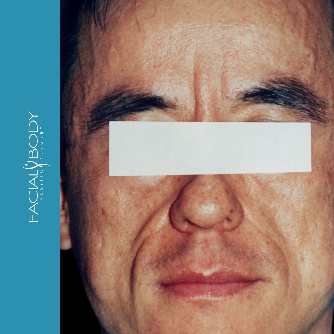 A close up of a man 's face with a blue background that says facial body