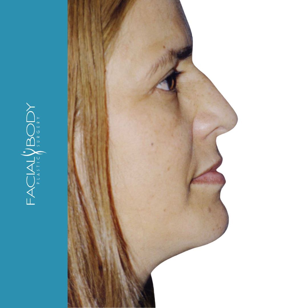 A close up of a woman 's face with facial body written on the bottom
