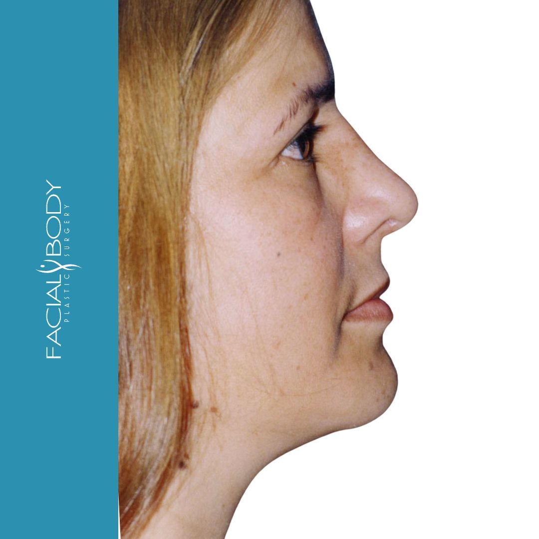 A woman 's face is shown in front of a blue sign that says facial body