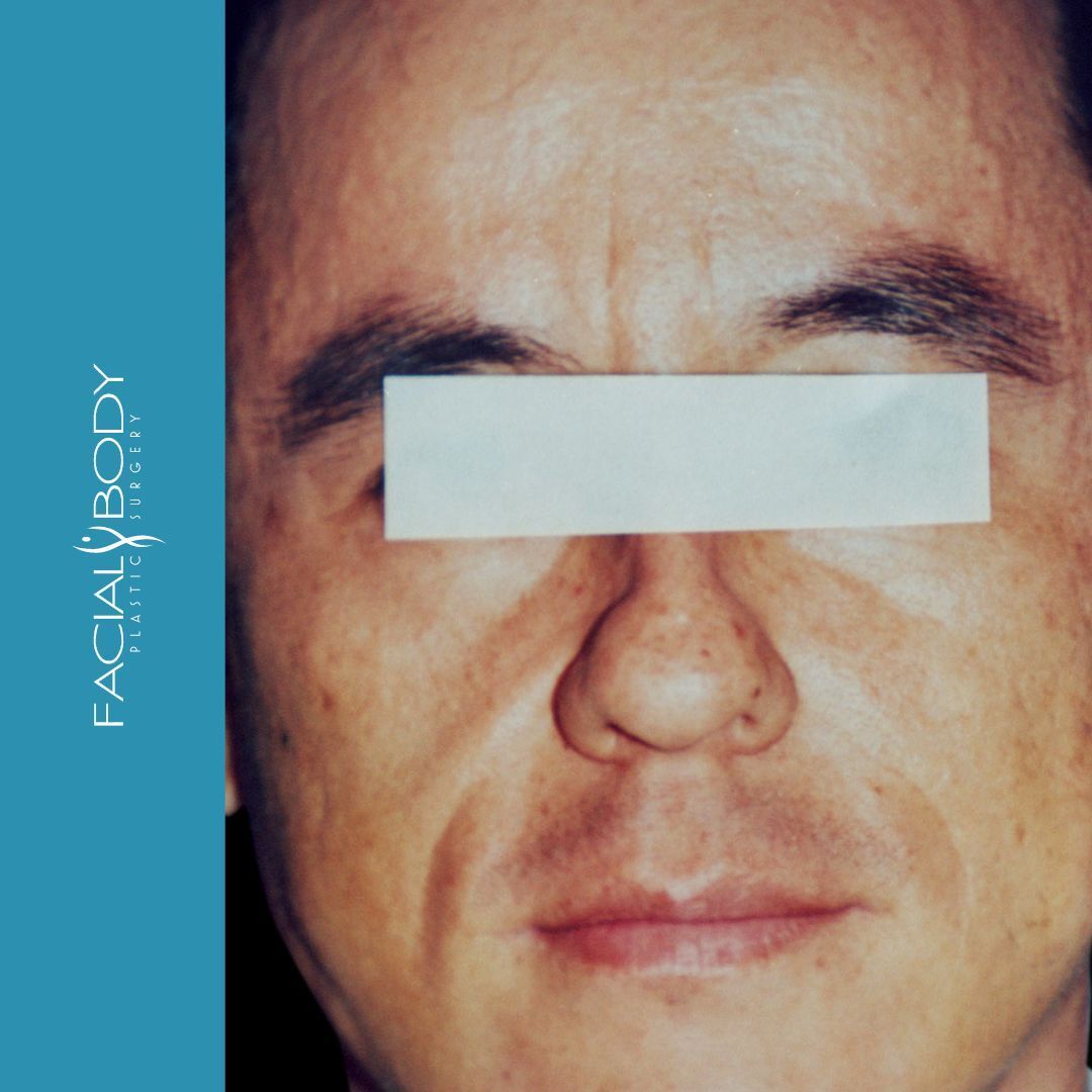 A close up of a man 's face with a blue background that says facial body