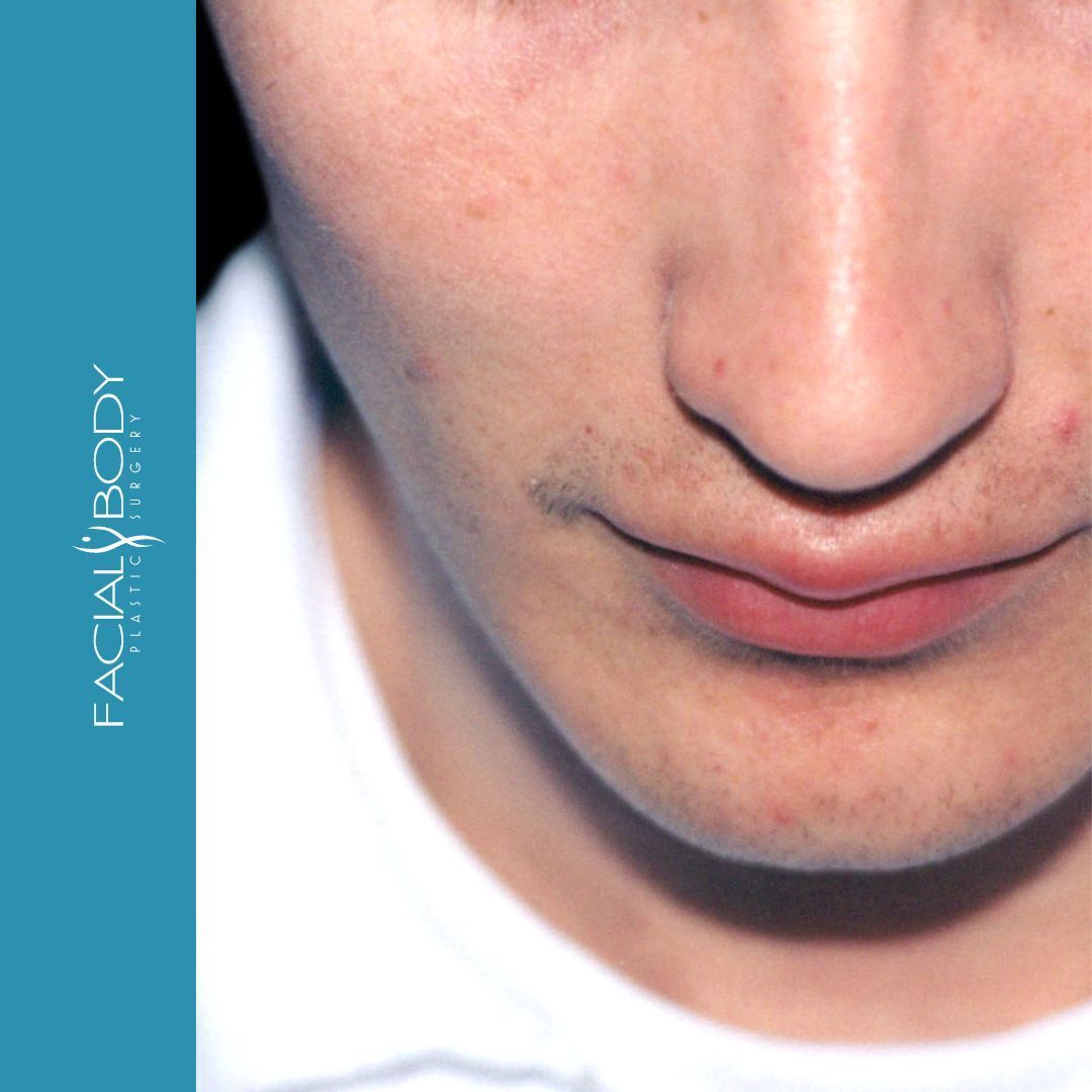 A close up of a man 's face with facial body written on the bottom
