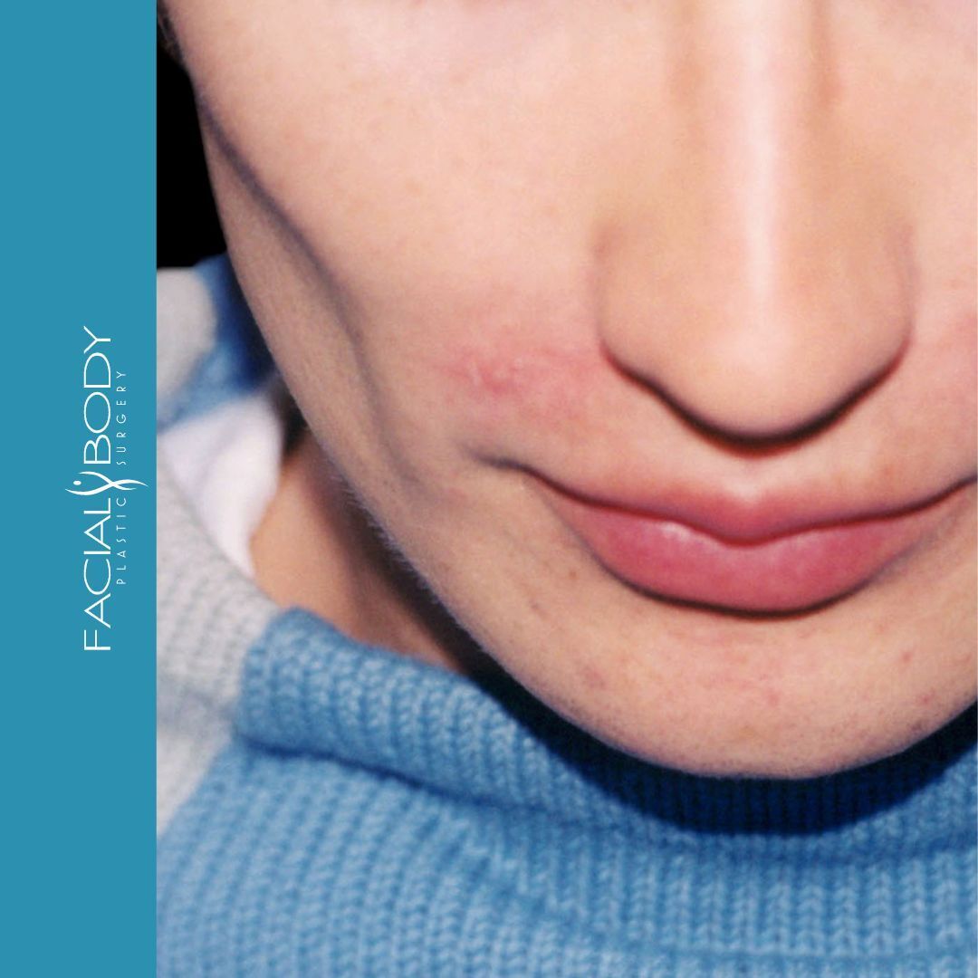 A close up of a woman 's face with the words facial body below it