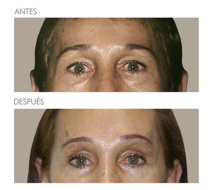 A before and after photo of a woman 's face