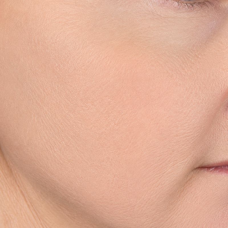 Close-up of a smooth cheek and lips with natural skin tone.