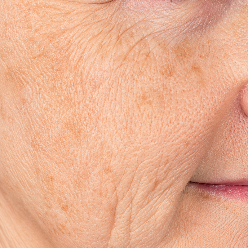 Close-up of a person’s cheek with visible fine lines and skin texture