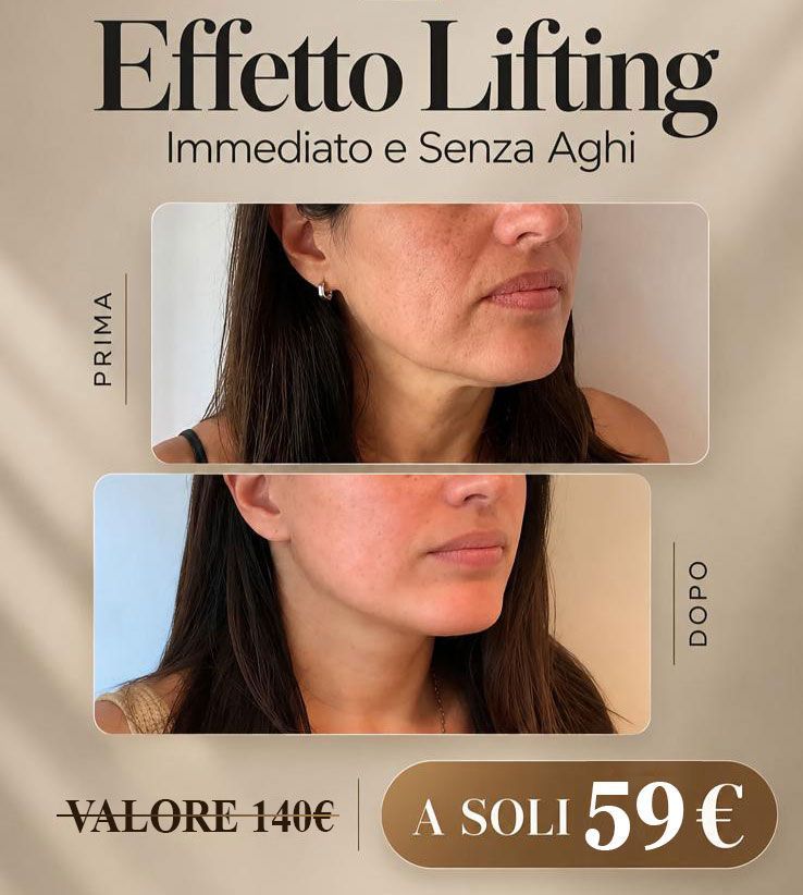 Annuncio promozionale per un effetto lifting immediato, con foto del profilo del collo prima e dopo affiancate e prezzo di 59 €