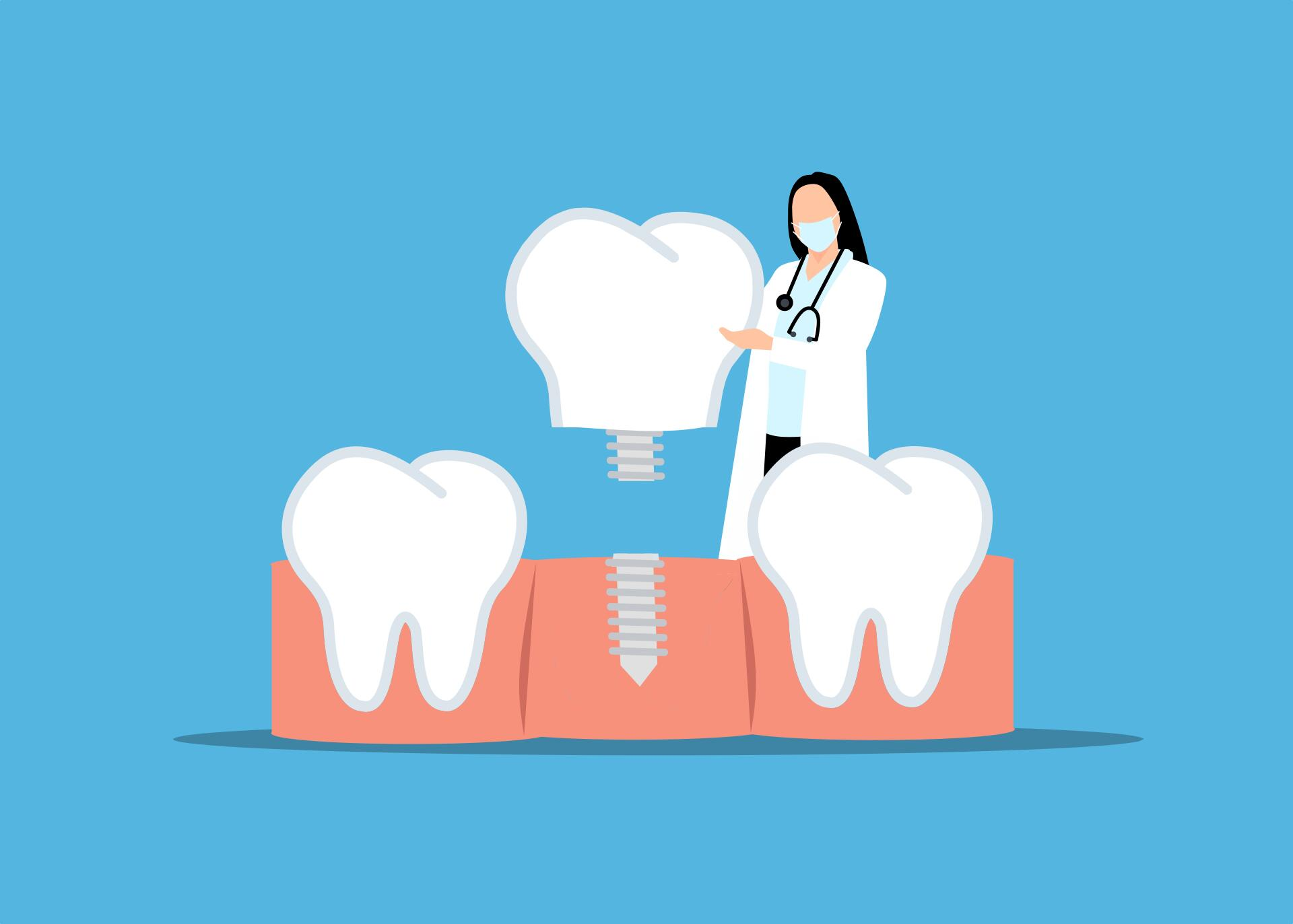 a dentist is standing next to a tooth with a screw in it