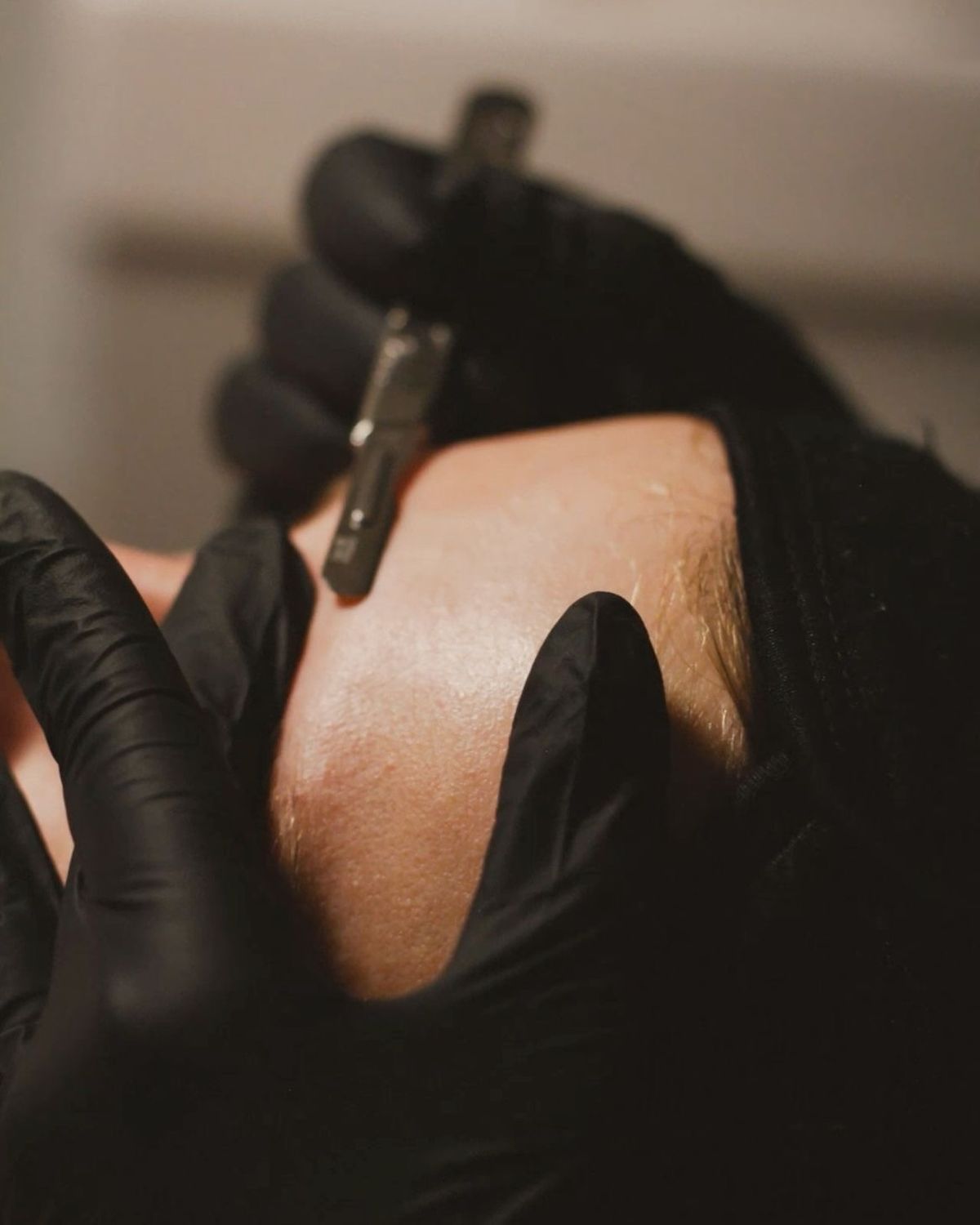 Handen met handschoenen voert dermaplaning uit met een machine op een onderarm in een close-up studioscène.