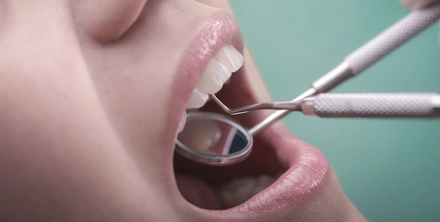 Inspecting teeth with mirror