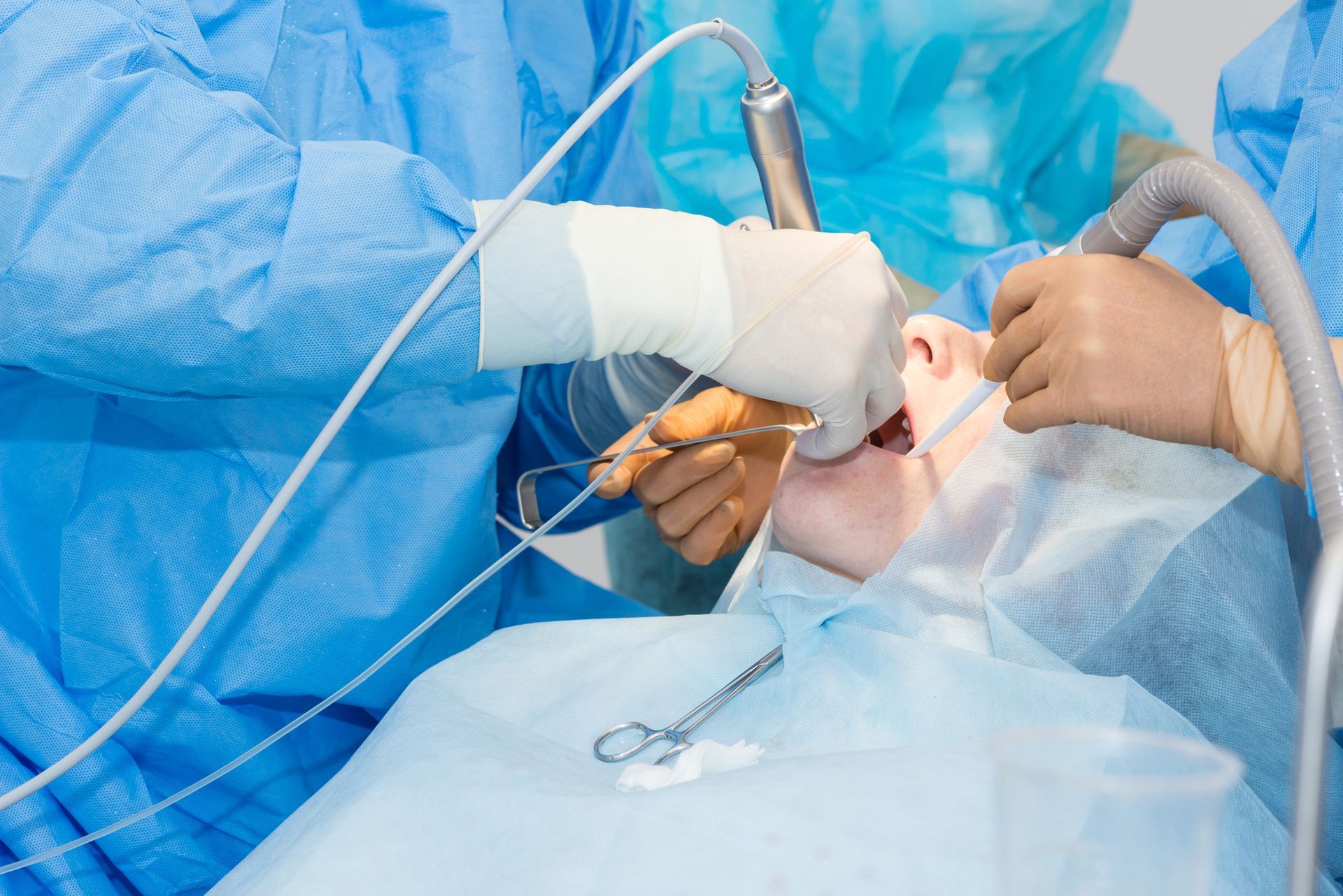 In una clinica sterile, un chirurgo dentale utilizza un trapano e un aspiratore nella bocca di un paziente durante un intervento.