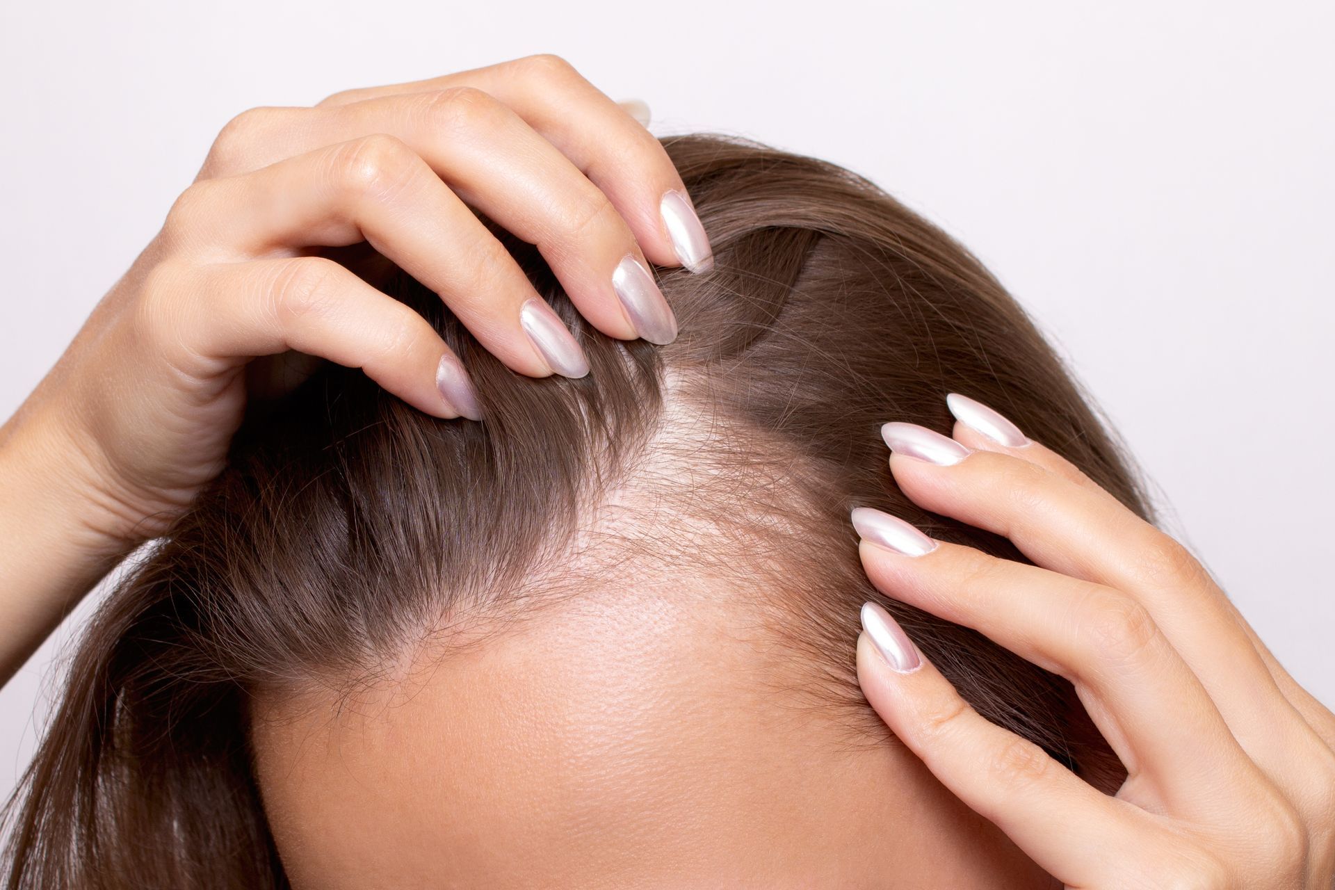 Hands parting hair to reveal a thinning scalp at the hairline