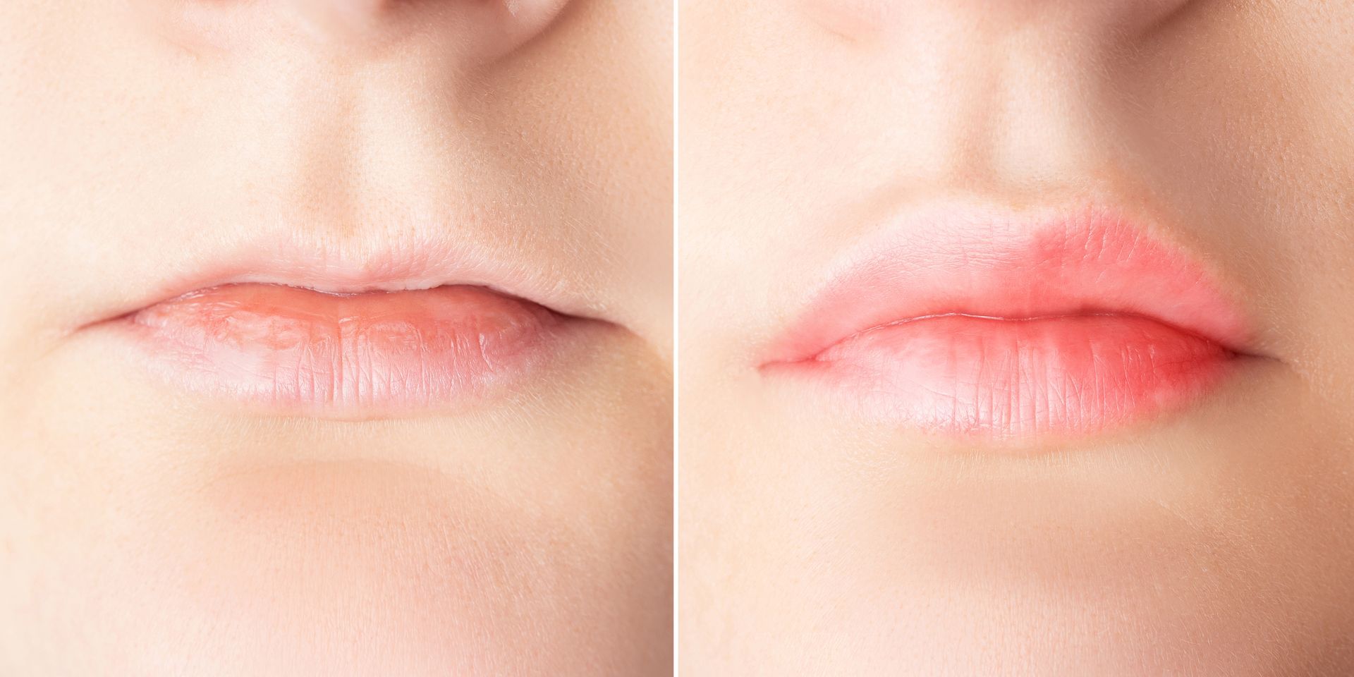 Woman considering dermal fillers, biostimulators, PRP and exosome skin treatments