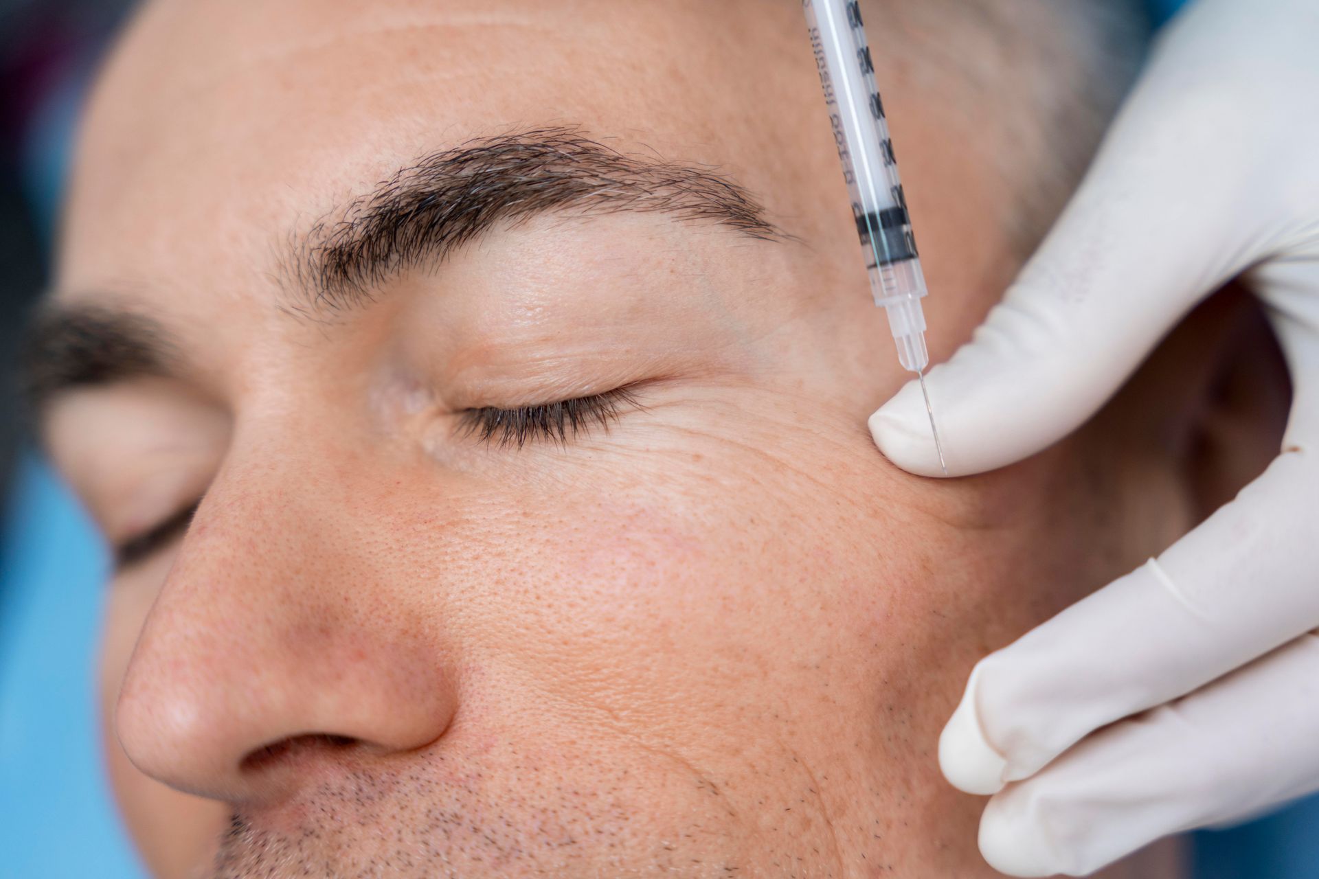 A man is getting a botox injection in his forehead.